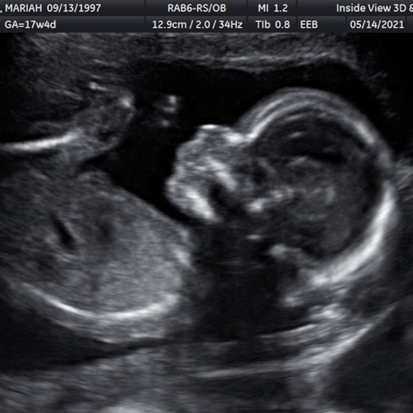 ❤️🌹 Meet Your Seller 🌹❤️ - Picture 4 of 4